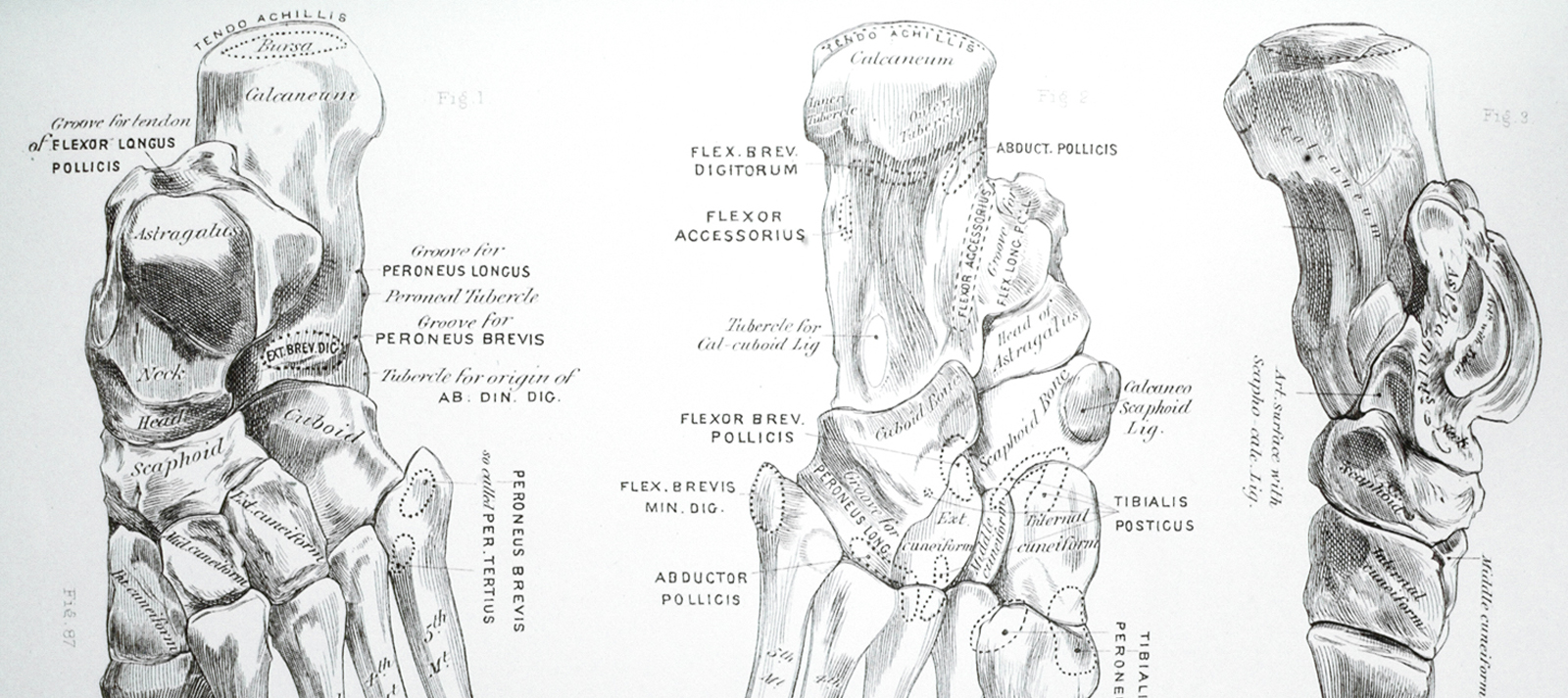 Balance Foot & Ankle - x-ray