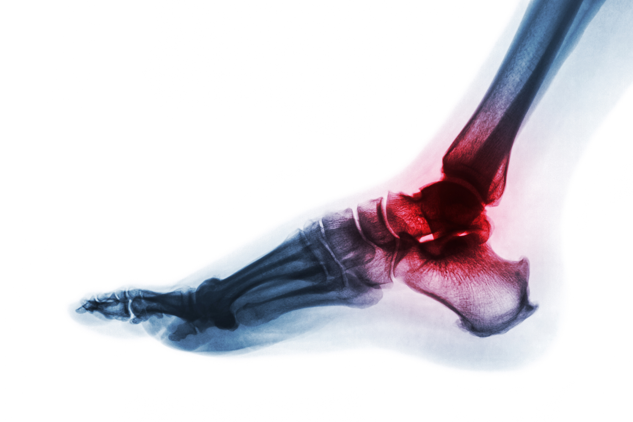 Balance Foot & Ankle - x-ray